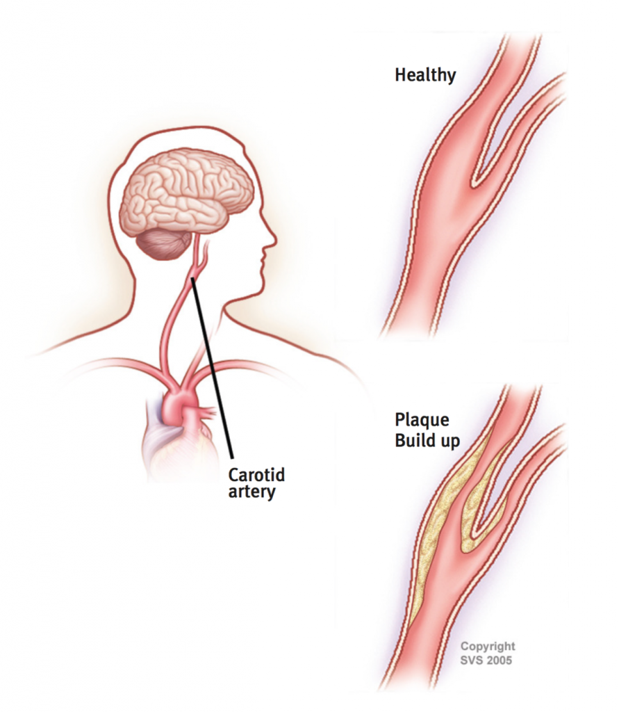 cardiothoracic-vascular-surgery-center-oaklawn-hospital