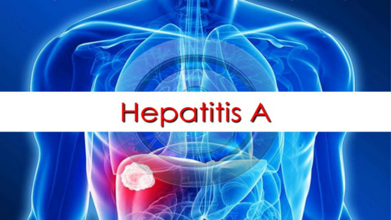 Michigan’s Hepatitis A Outbreak - Oaklawn Hospital
